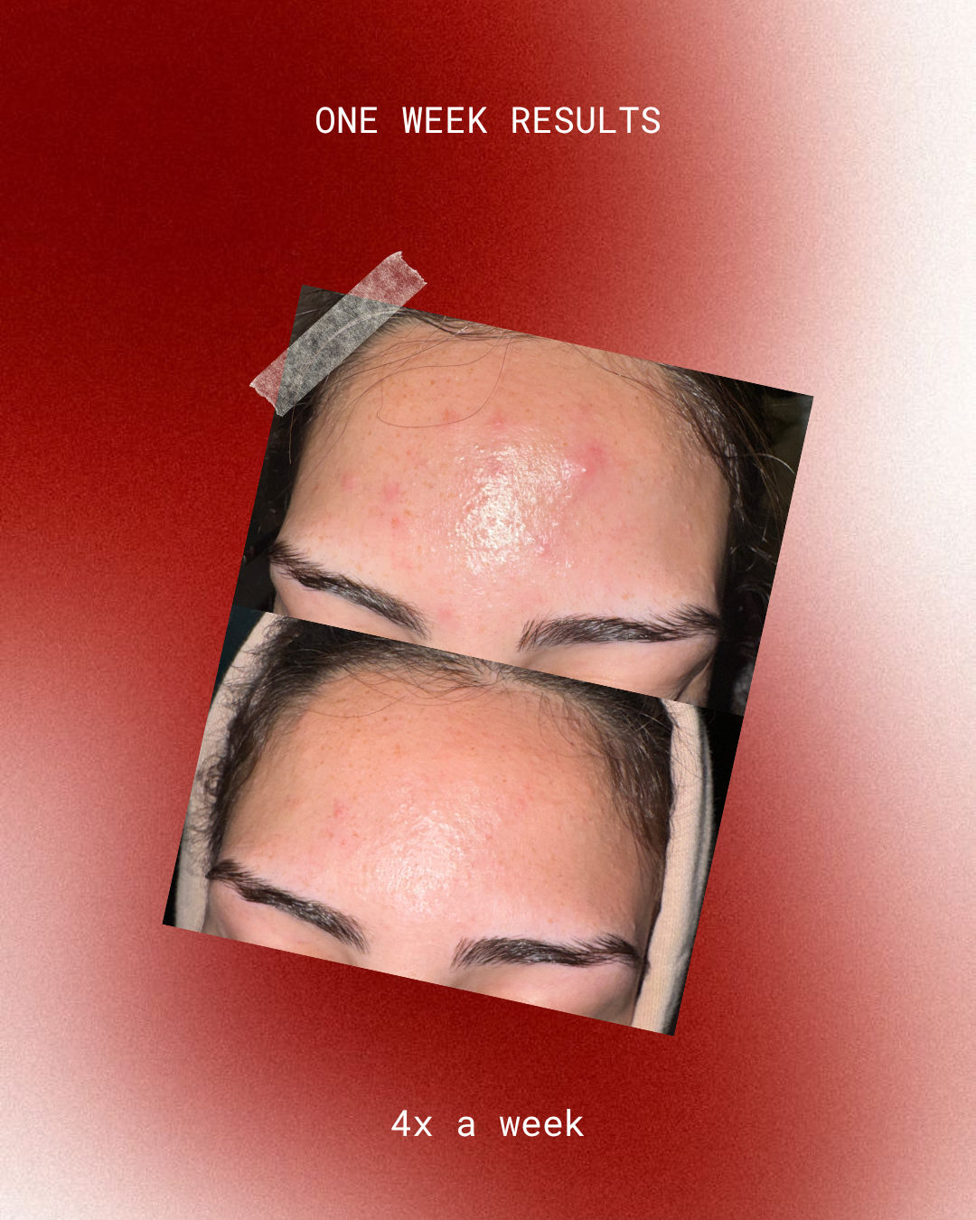 Exo-Vion Peel Pads (preorder)