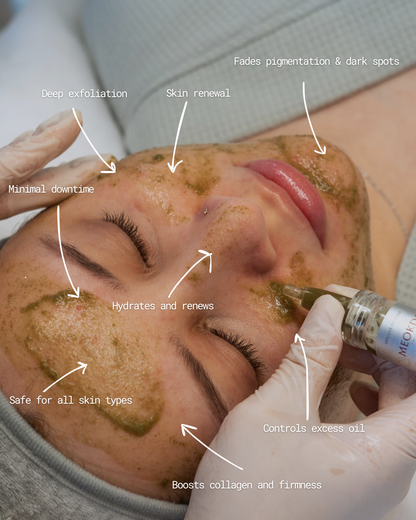 BIO-X Spicule Peel Set