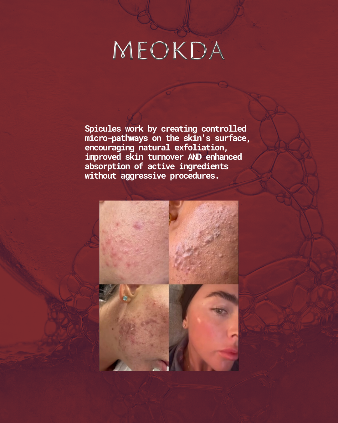 BIO-X Spicule Peel Set