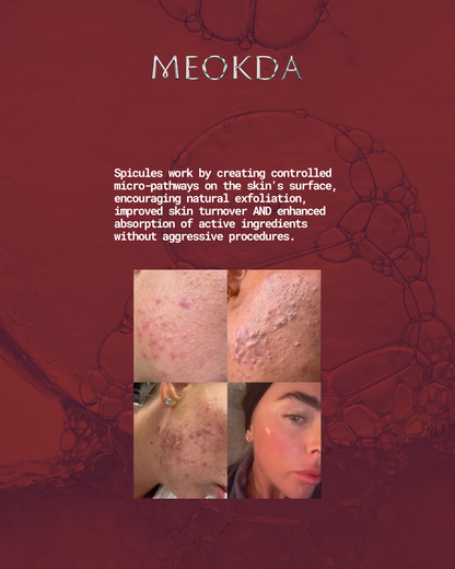 BIO-X Spicule Peel Set